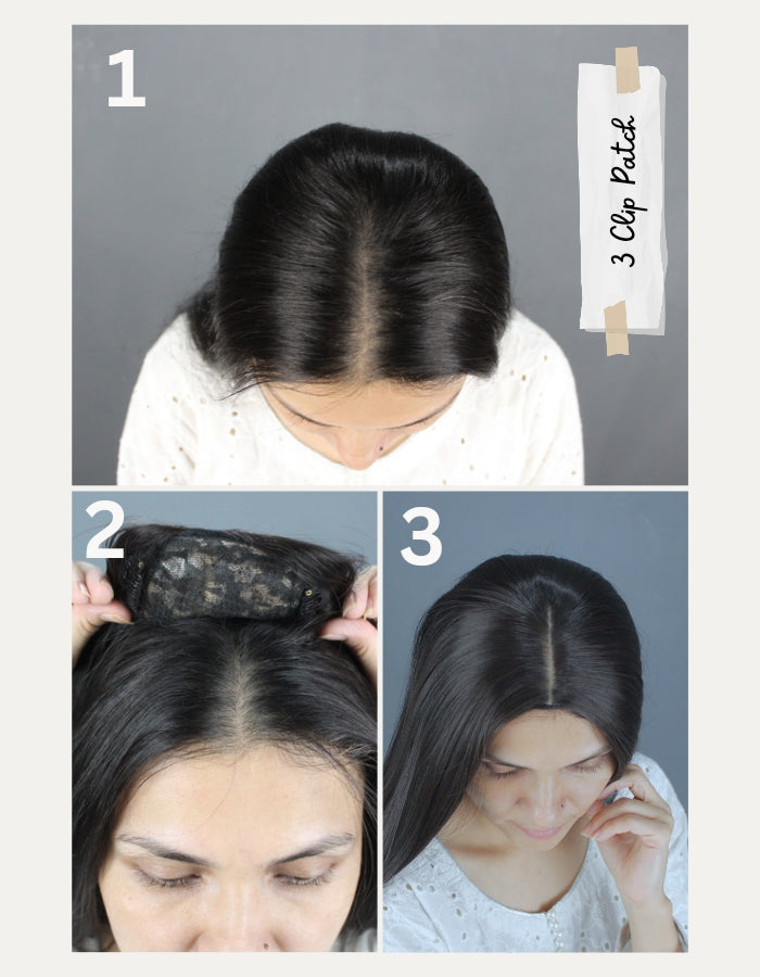 03 Clips Hair Patch Style A – Discreet front baldness solution with natural-looking hair integration.