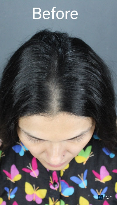 02 Clips Hair Patch with Parting| Zebaish Wigs & Extensions